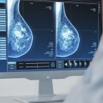 Digitalna mamografija Sarajevo – Pregled Eurofarm Centar Poliklinika