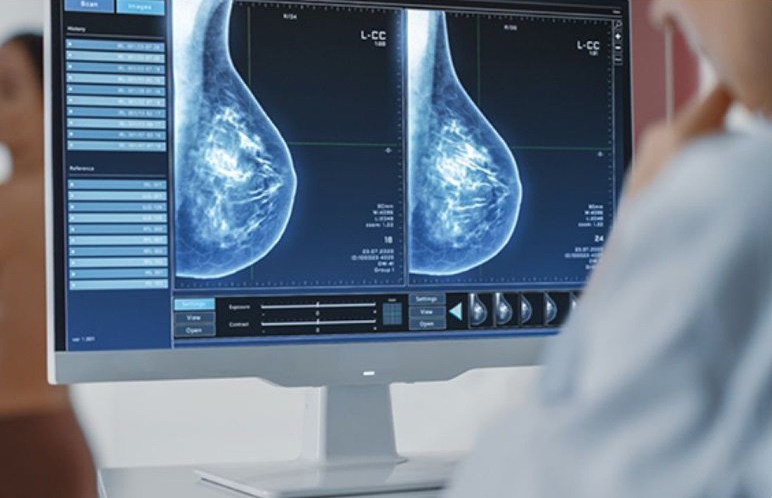 Digitalna mamografija Sarajevo - Pregled Eurofarm centar poliklinika