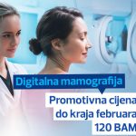 Digitalna mamografija Sarajevo – Promotivna cijena pregleda